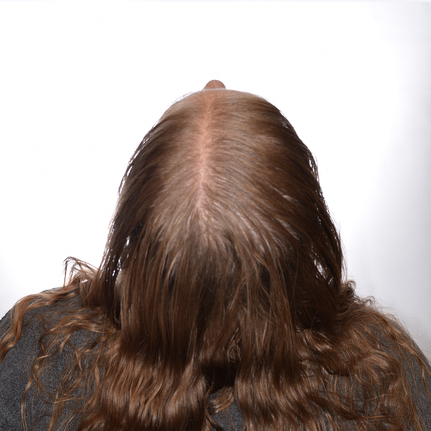 Amber-BackTilt-Before