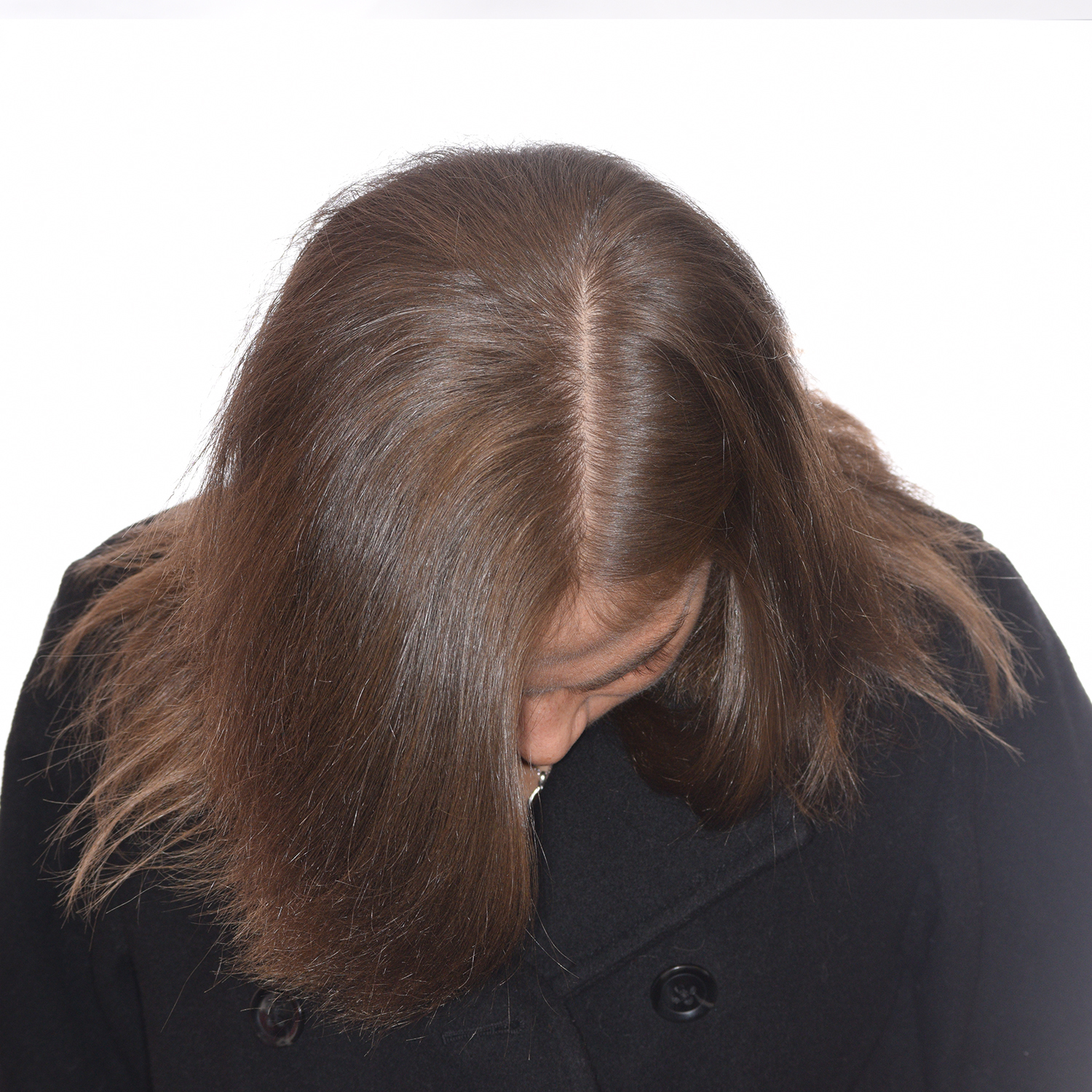 Amber-FrontTilt-After