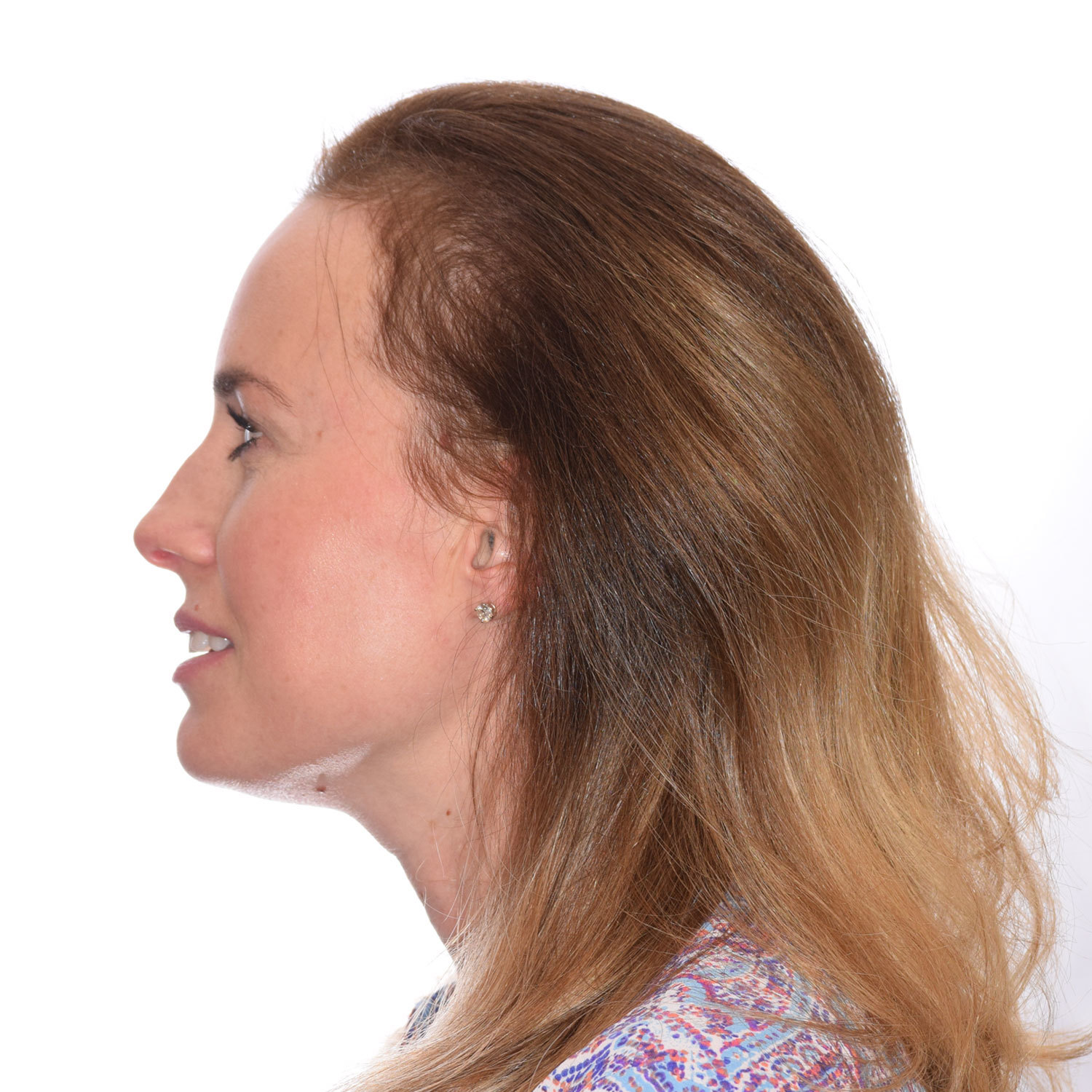 Jennifer-Burkus-Left2-After