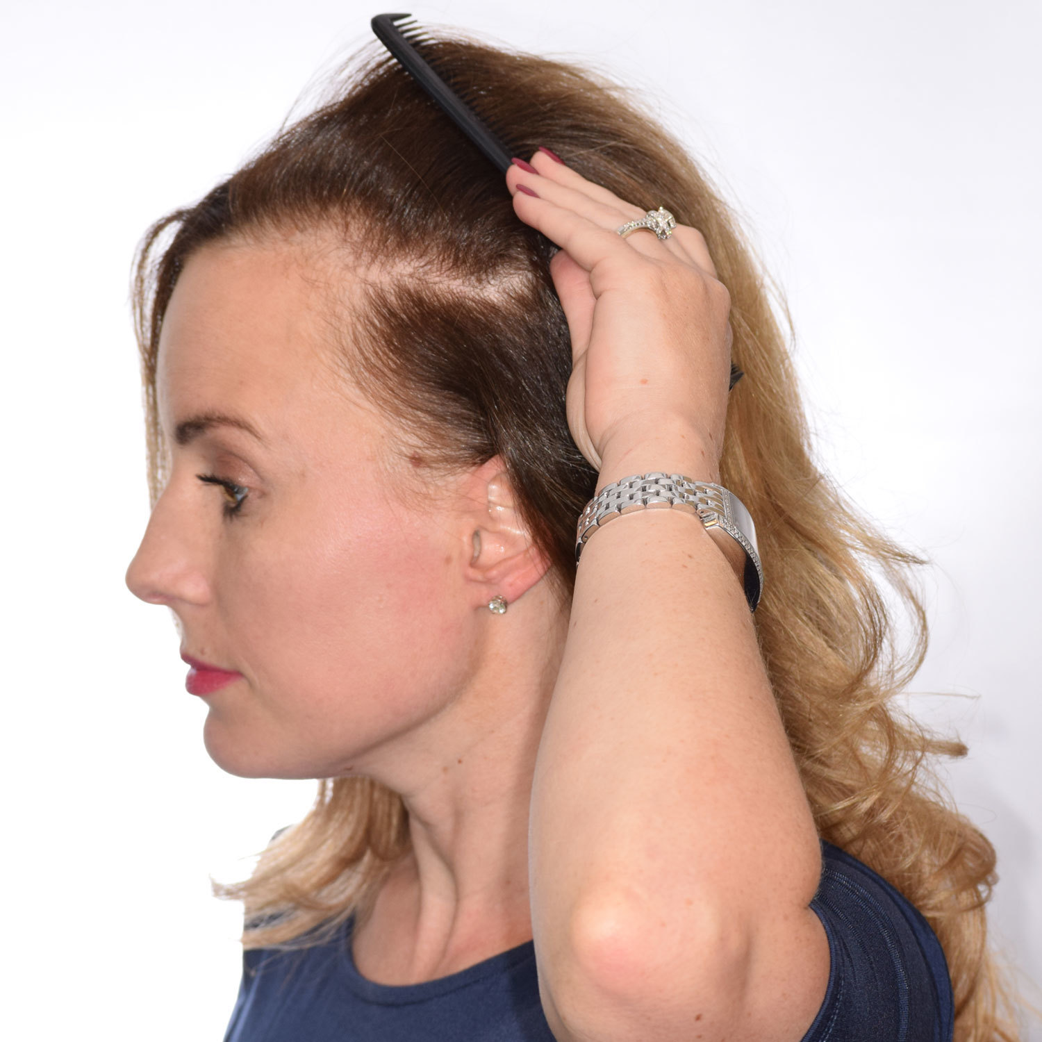 Jennifer-Burkus-Left2-Befor