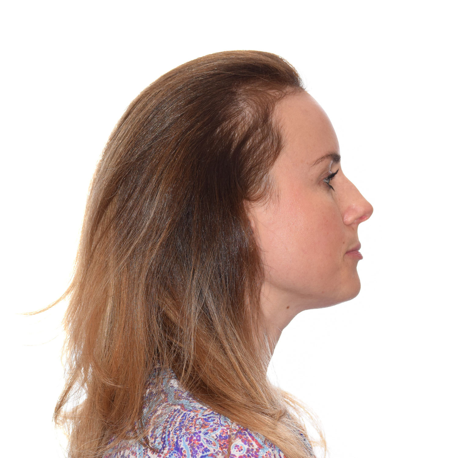 Jennifer-Burkus-Right-After