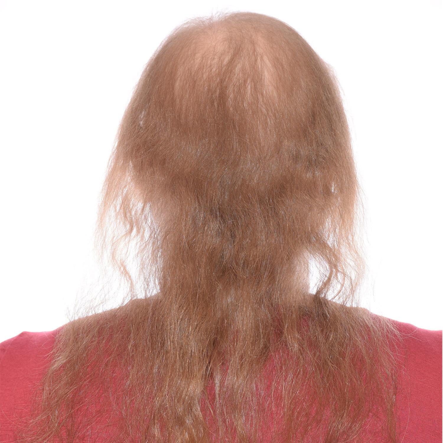 Katelyn-Gibbens-Back-Before