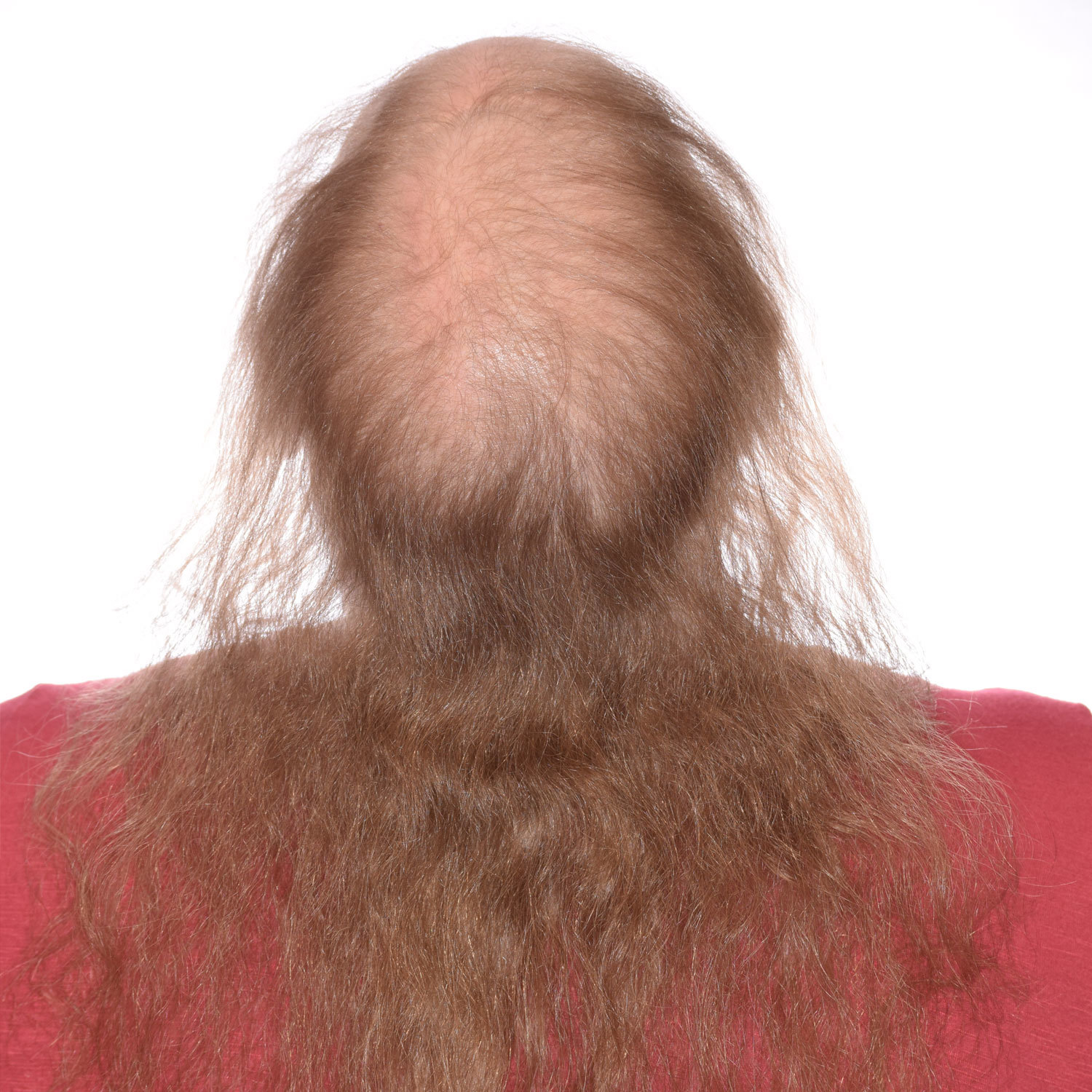 Katelyn-Gibbens-BackTilt-Be