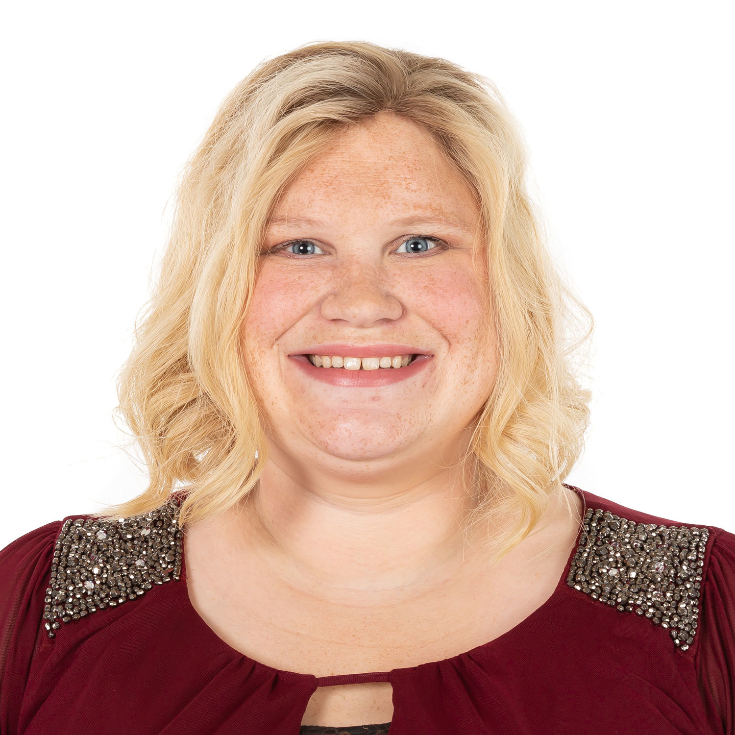 after non-surgical hair replacement