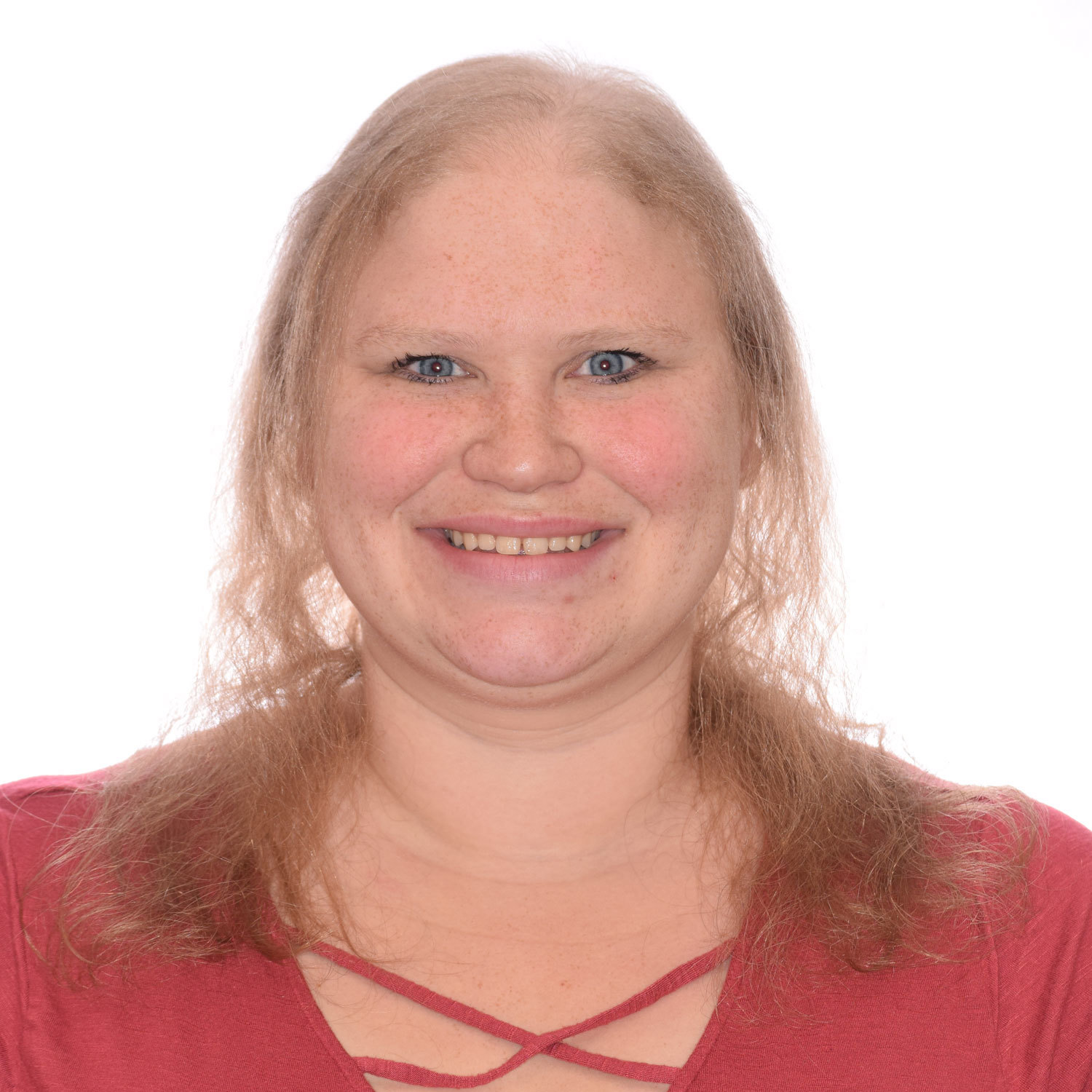 before non-surgical hair replacement