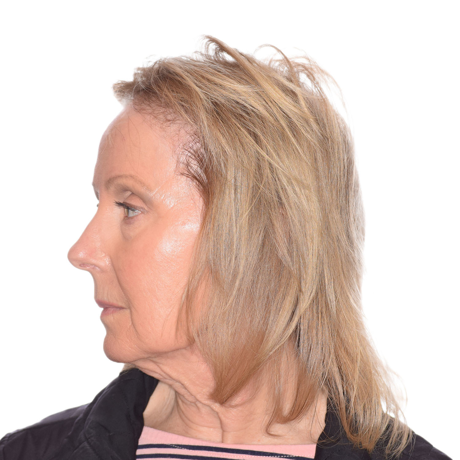 Kathy-Kappes-Left-Before