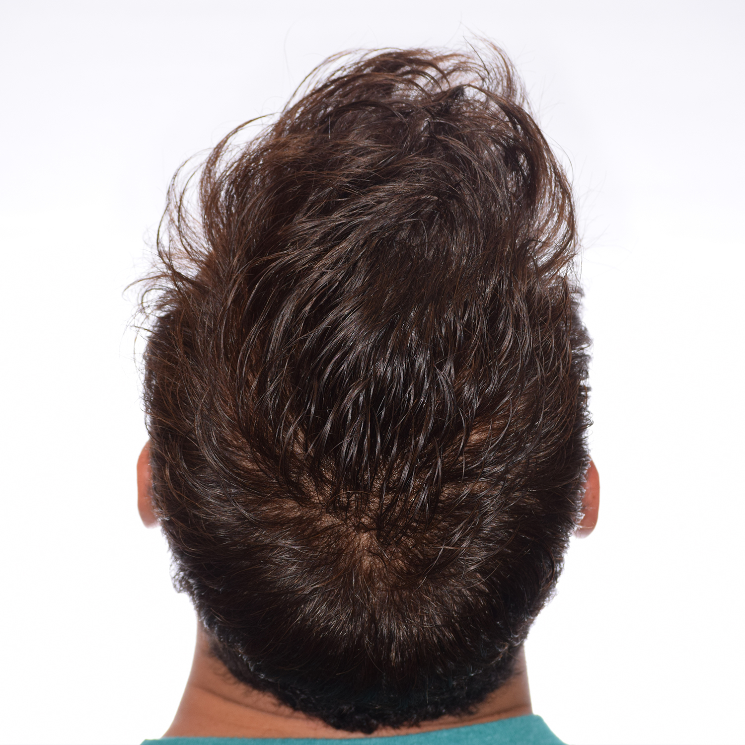 Bryan-BackTilt-After