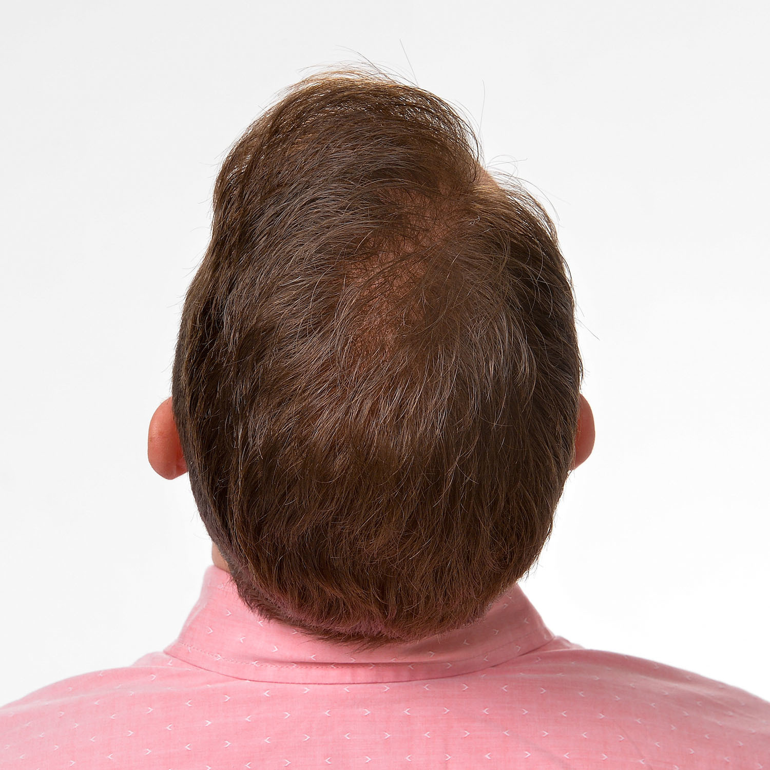 Graham-BackTilt-After2