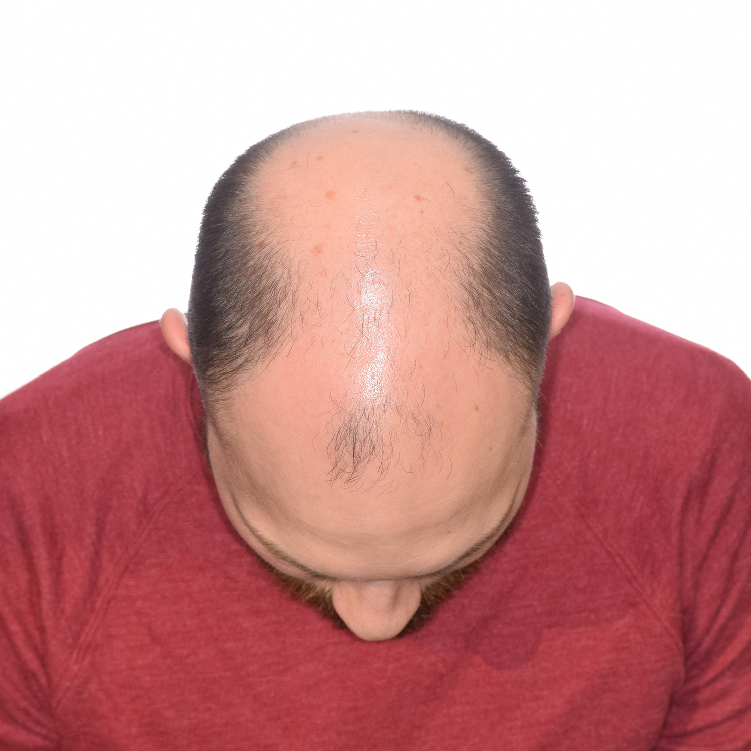 Graham-FrontTilt-Before