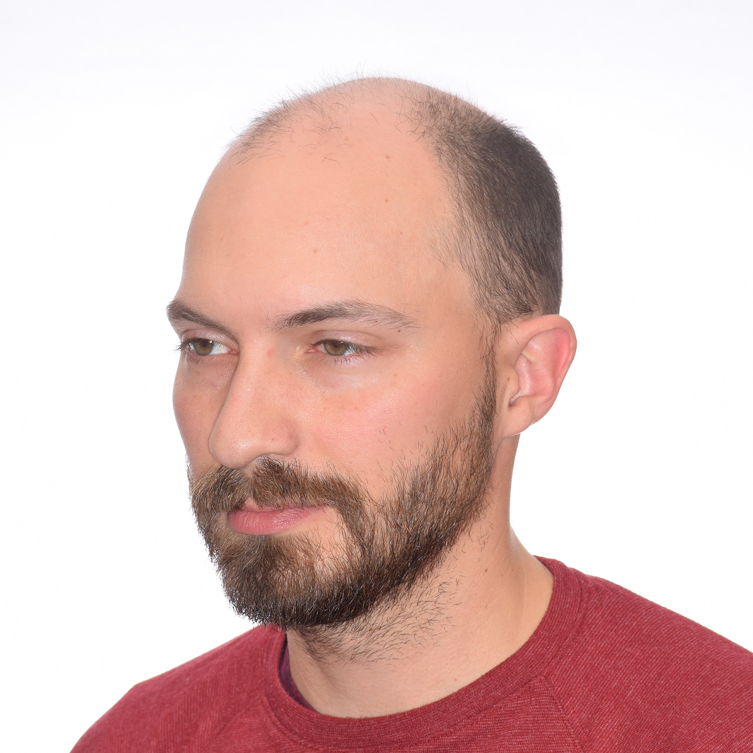 Graham-Left45-Before