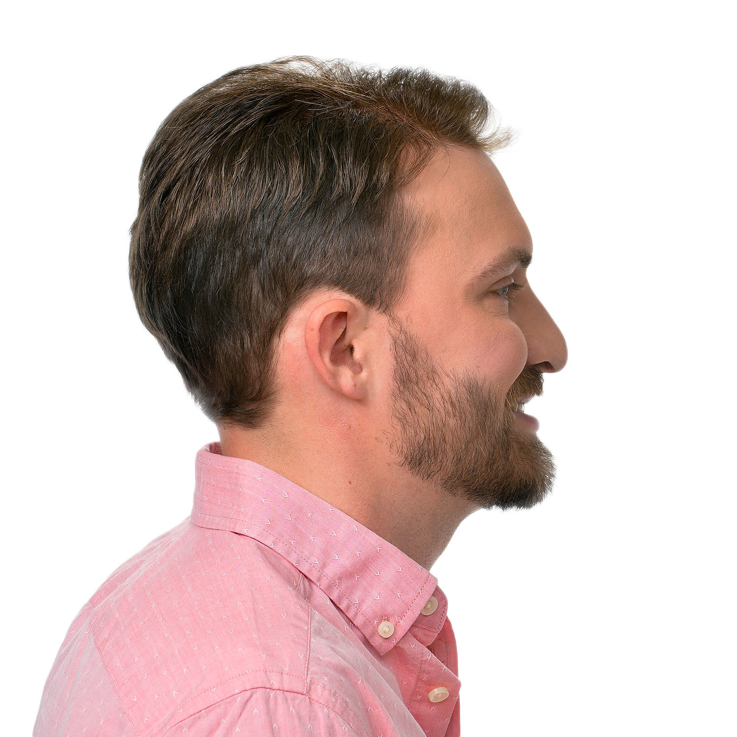 Graham-Poteet-After-Right