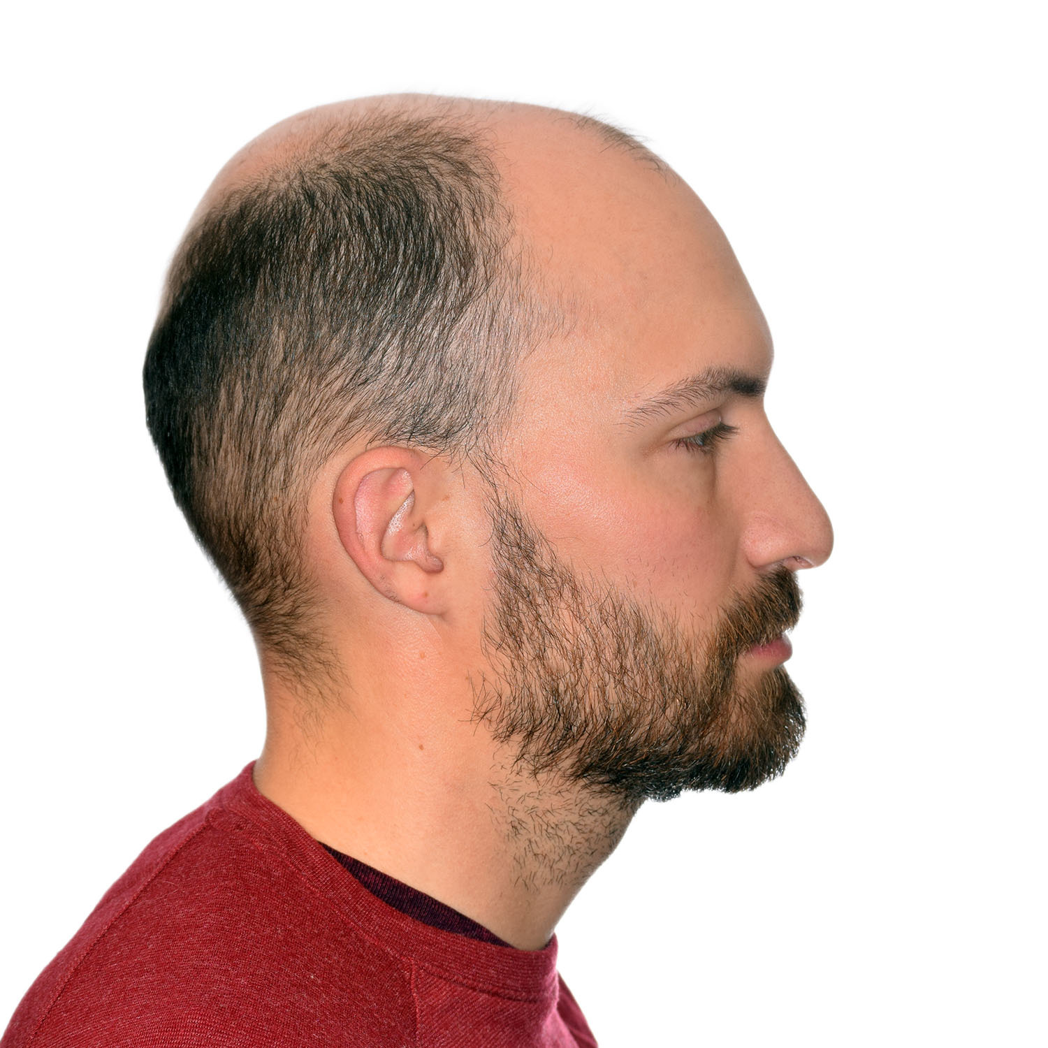 Graham-Poteet-Before-Right