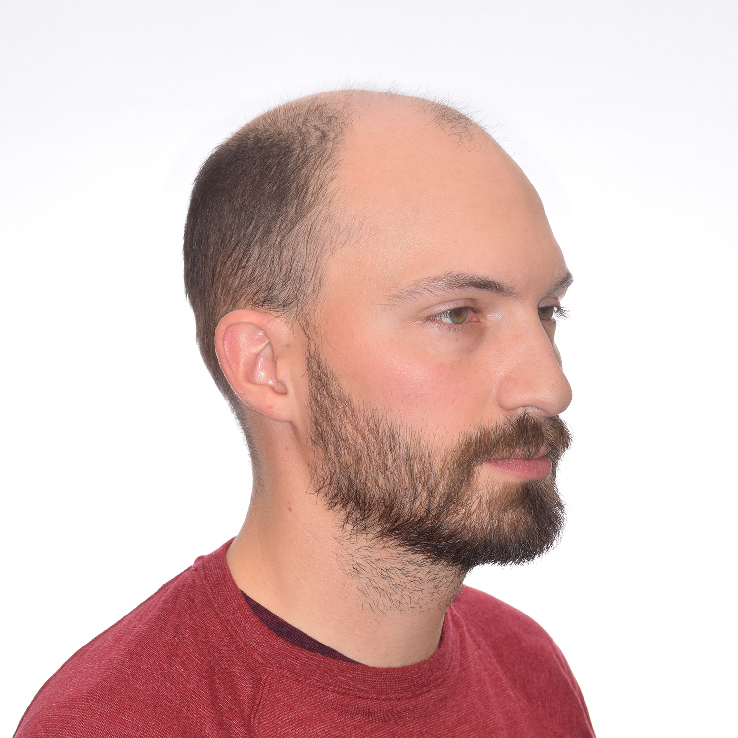 Graham-Right45-Before