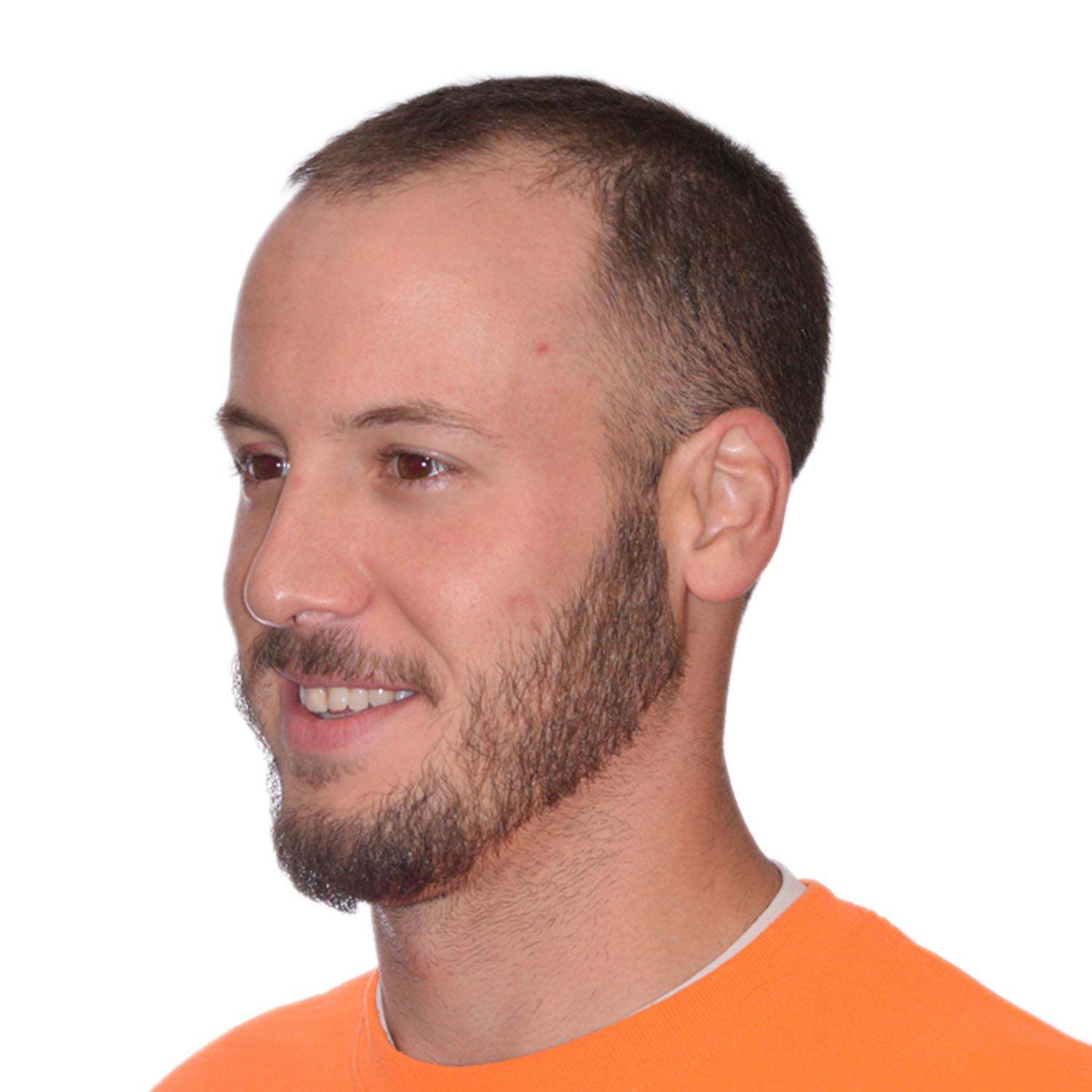 Nick-Angeloff-45-Left-Before2