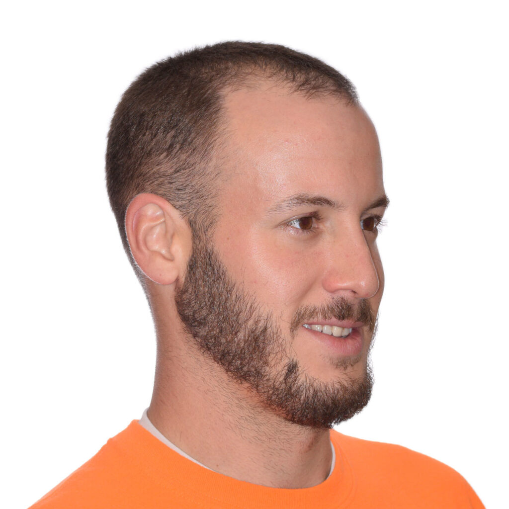 Nick-Angeloff-45-Right-Before2