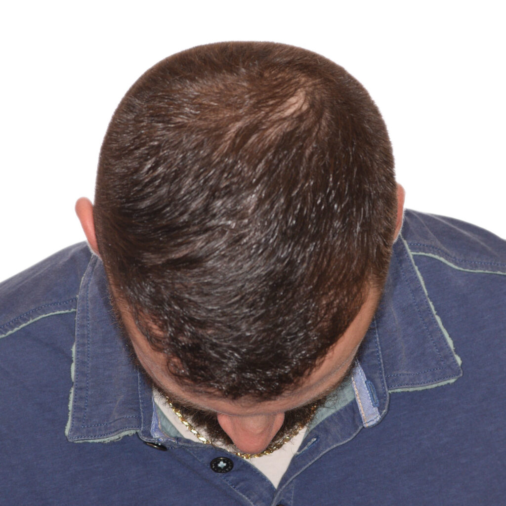 Nick-Angeloff-FrontTilt-After2