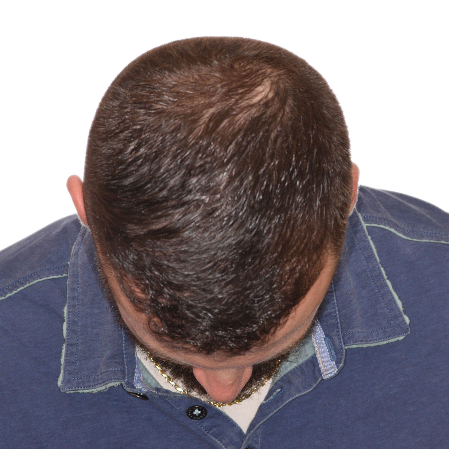 Nick-Angeloff-FrontTilt-After2