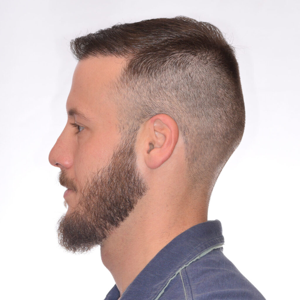 Nick-Angeloff-Left-After2