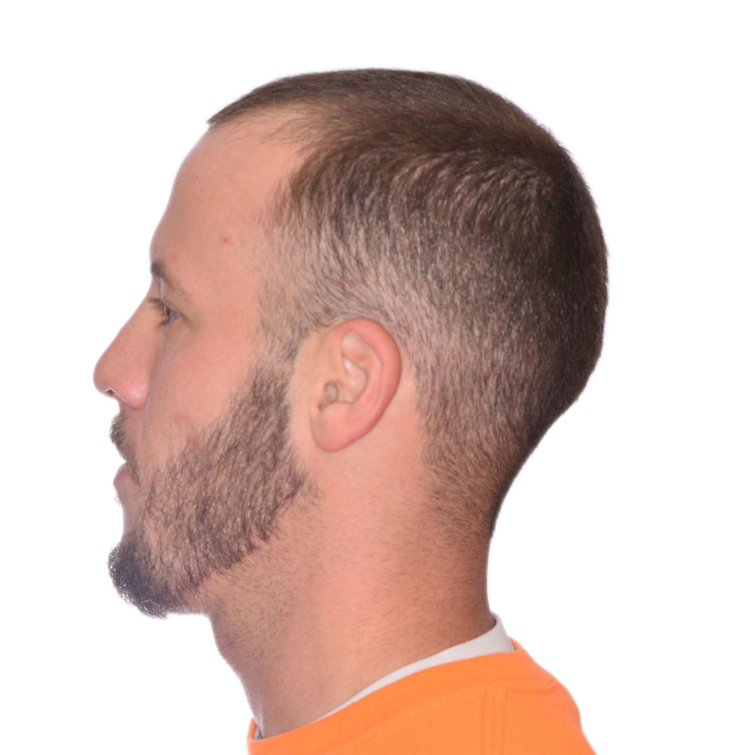 Nick-Angeloff-Left-Before2