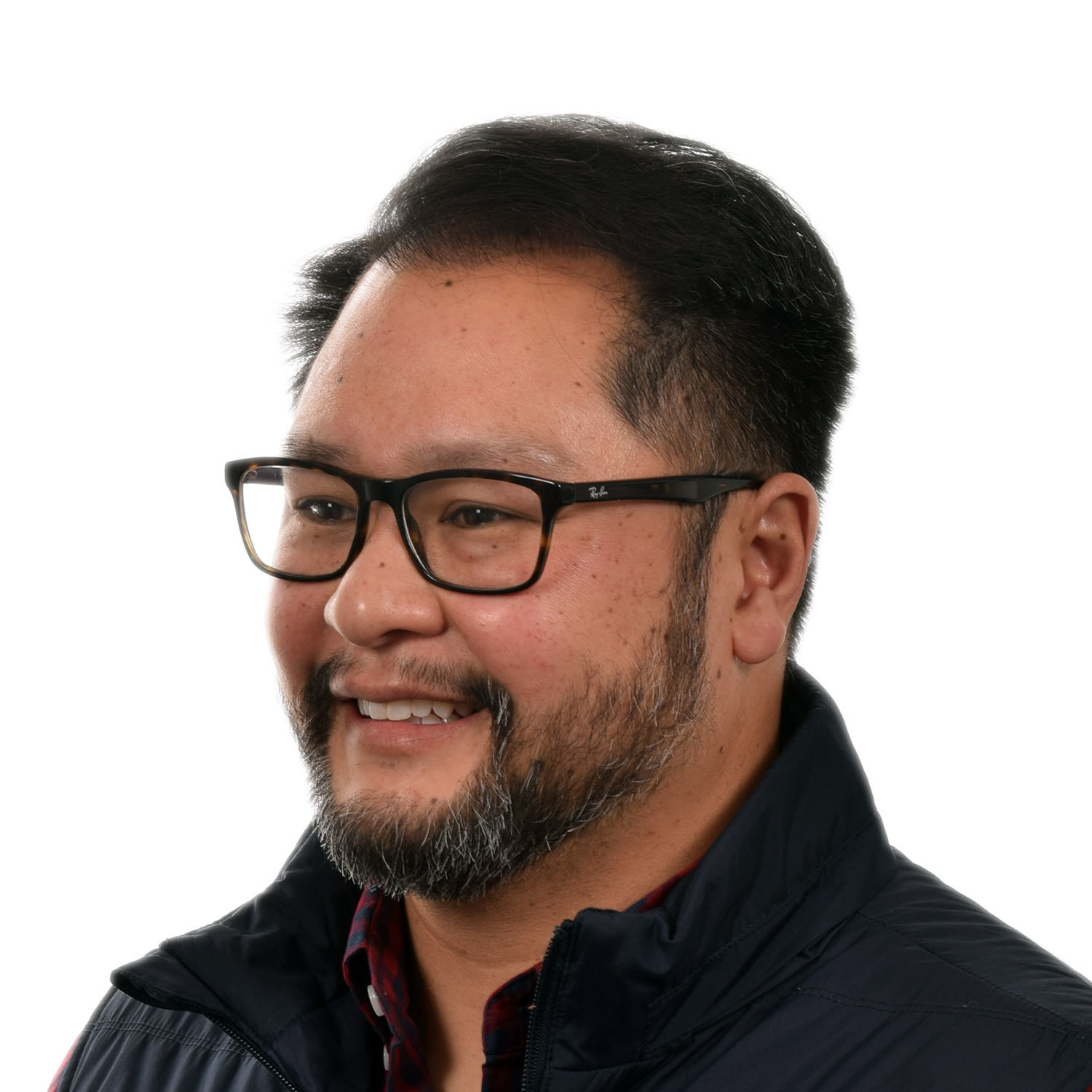 Justin-Lo-Left45-After