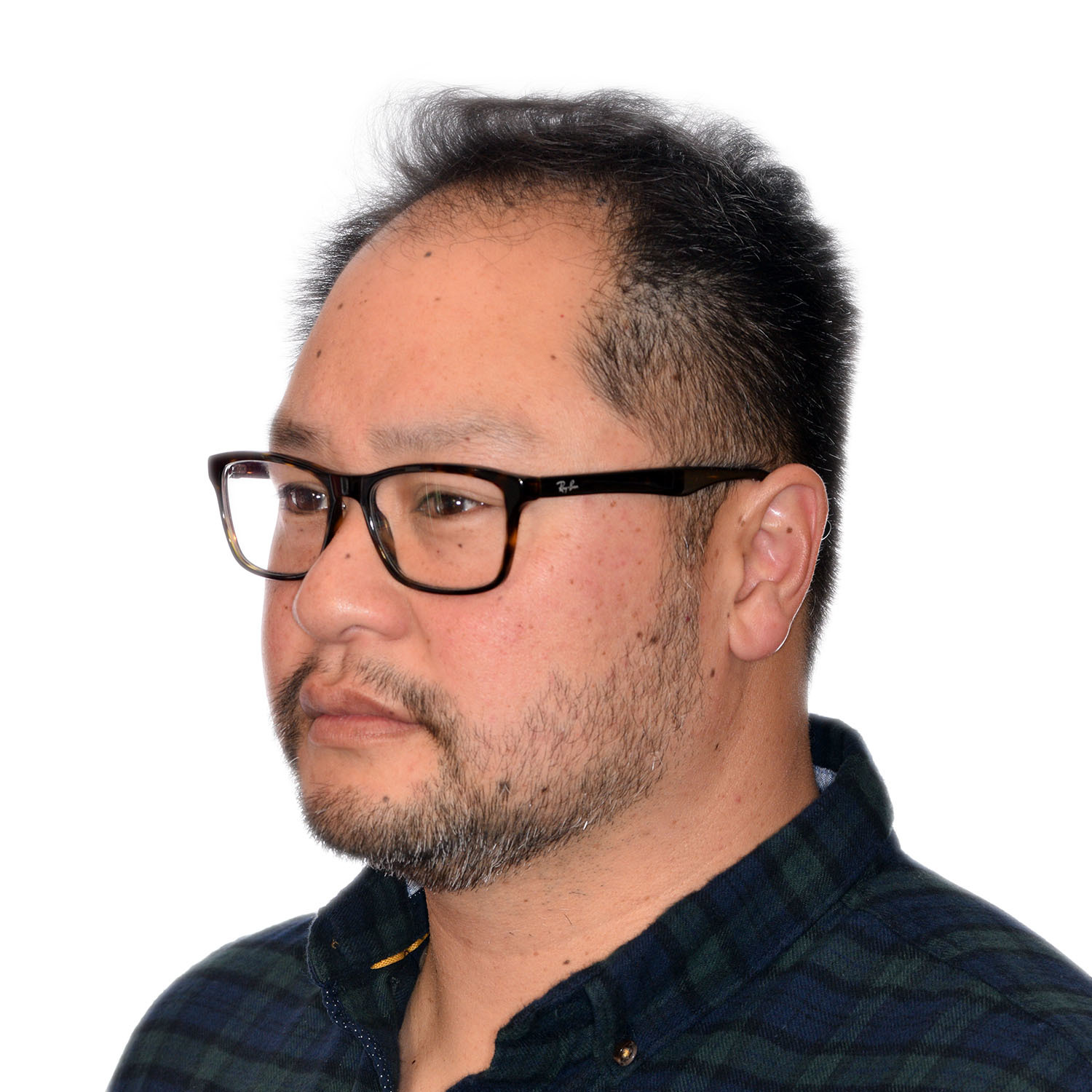 Justin-Lo-Left45-Before