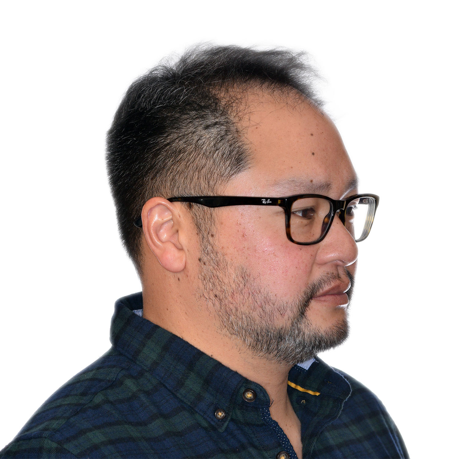 Justin-Lo-Right45-Before