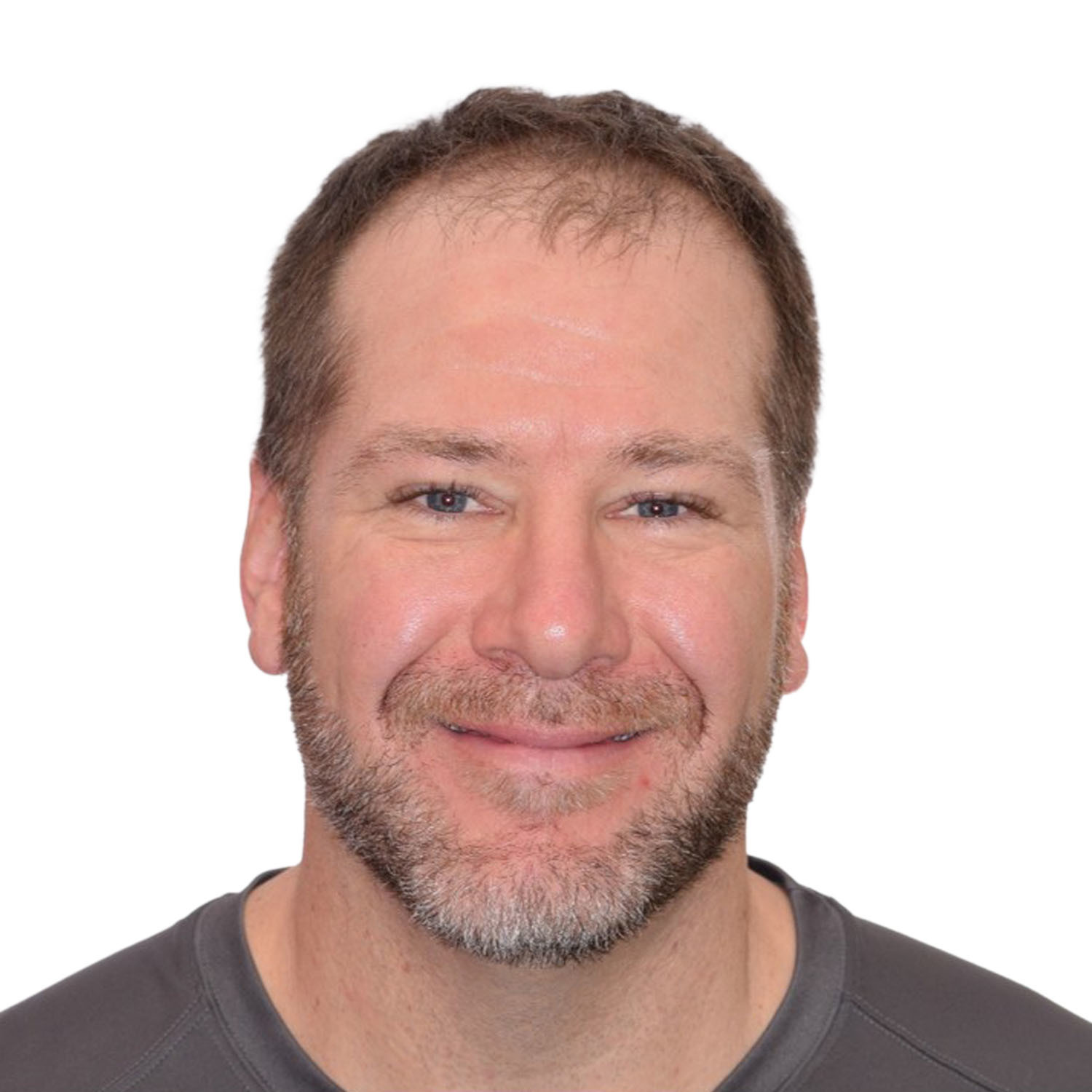 before a hair transplant