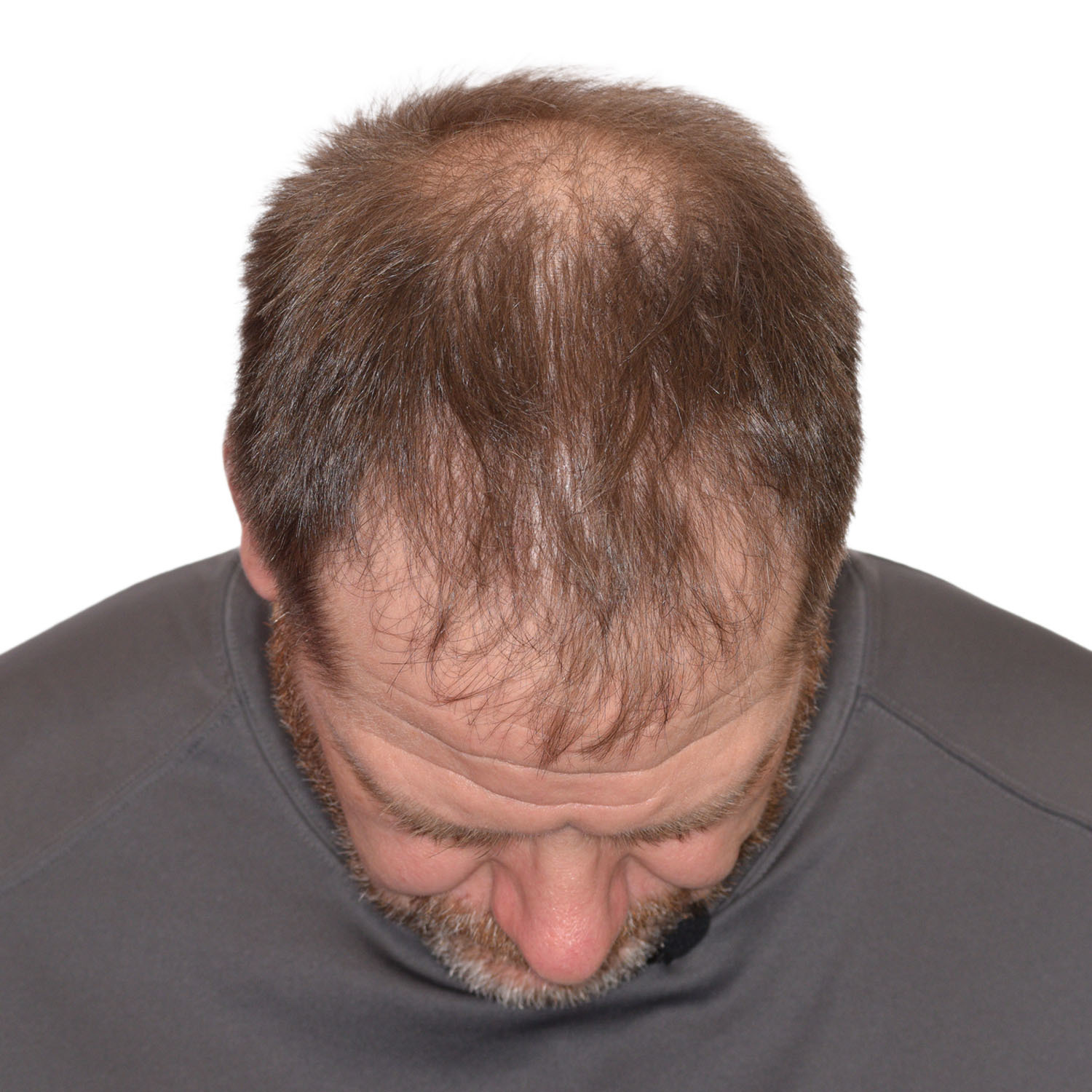 Rick-DeMulling-FrontTilt-Be