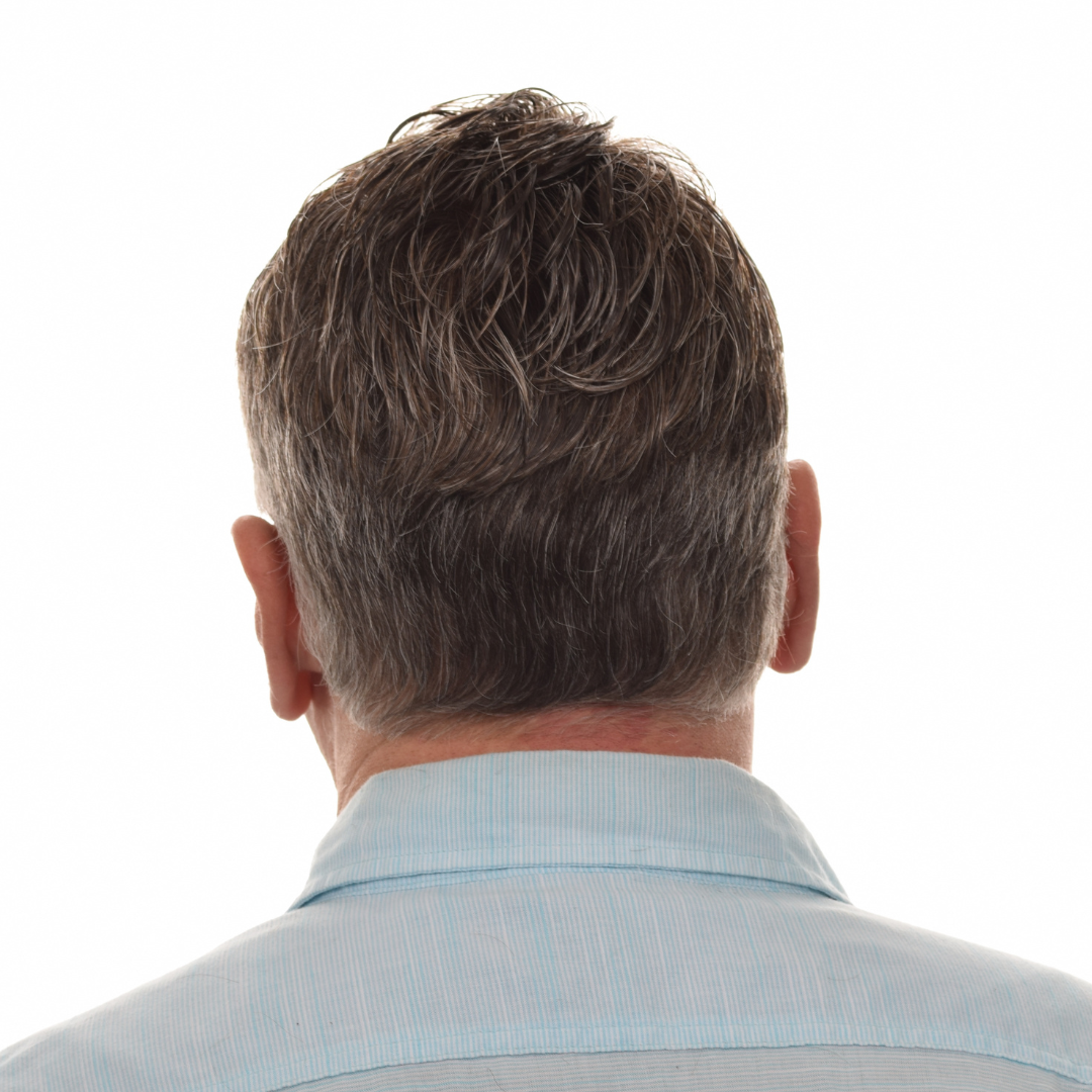 Jason-Shawver-Non-Surg-After-Back