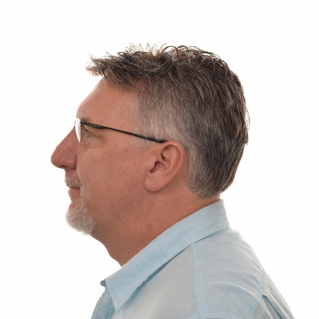 Jason-Shawver-Non-Surg-After-Left-Side