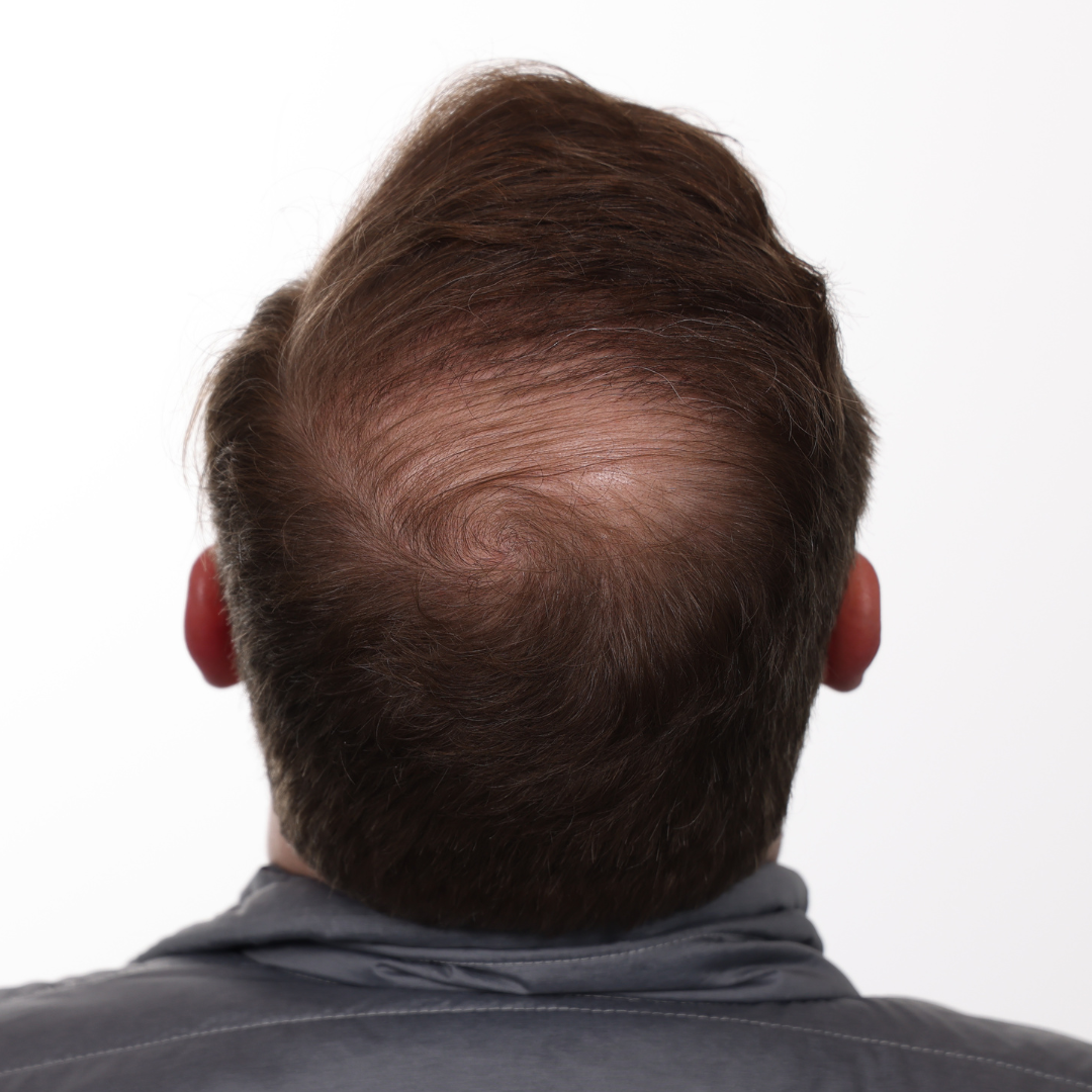 Thomas-Wagers-Back-After