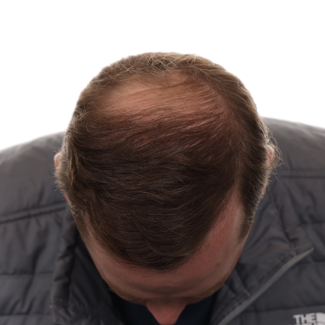 Thomas-Wagers-Front-Tilt-Before