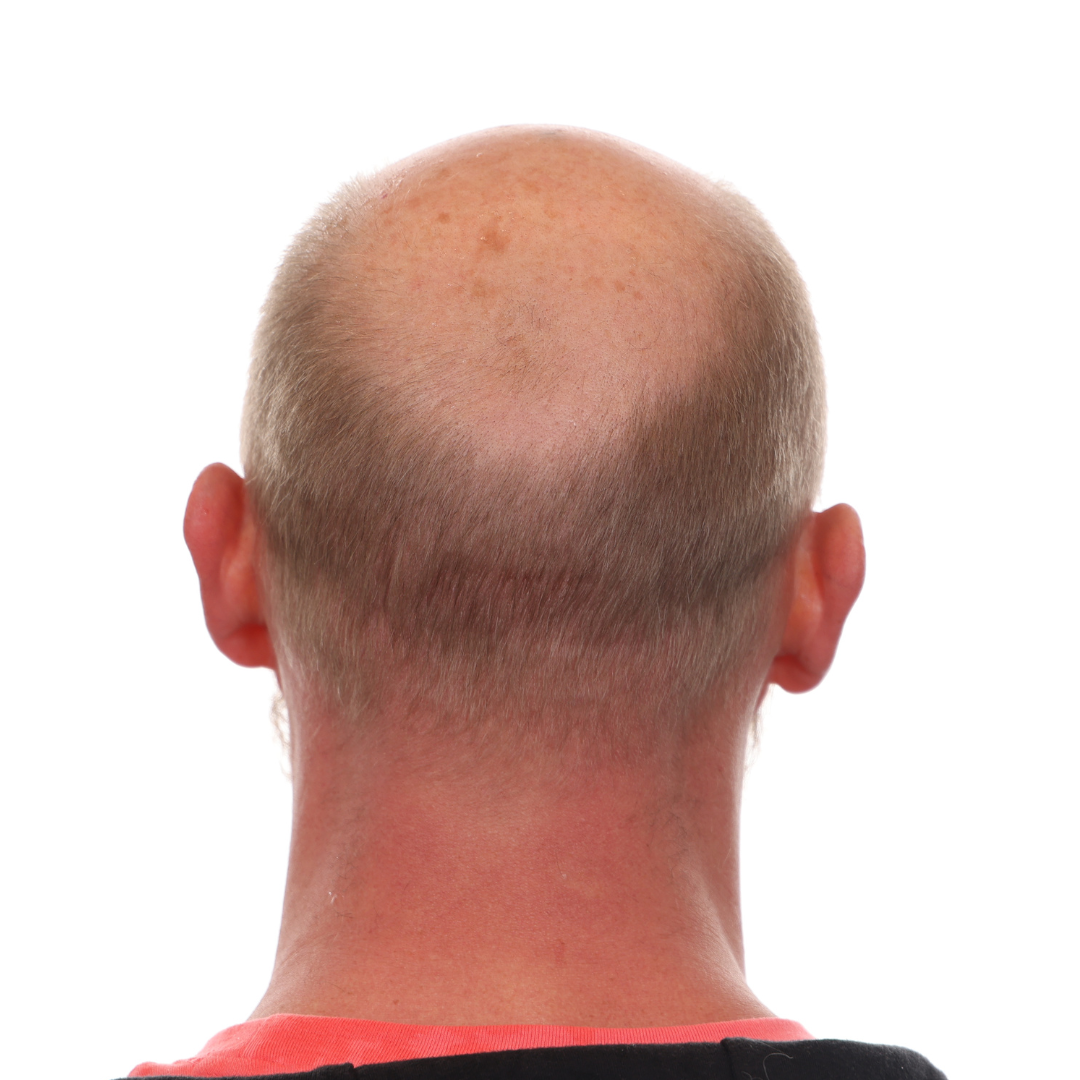 Nick-Jackson-Back-Before