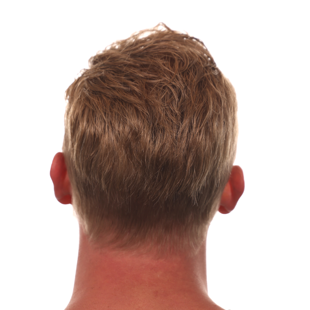 Nick-Jackson-Back-Tilt-After