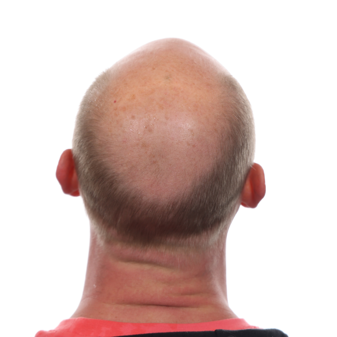 Nick-Jackson-Back-Tilt-Before