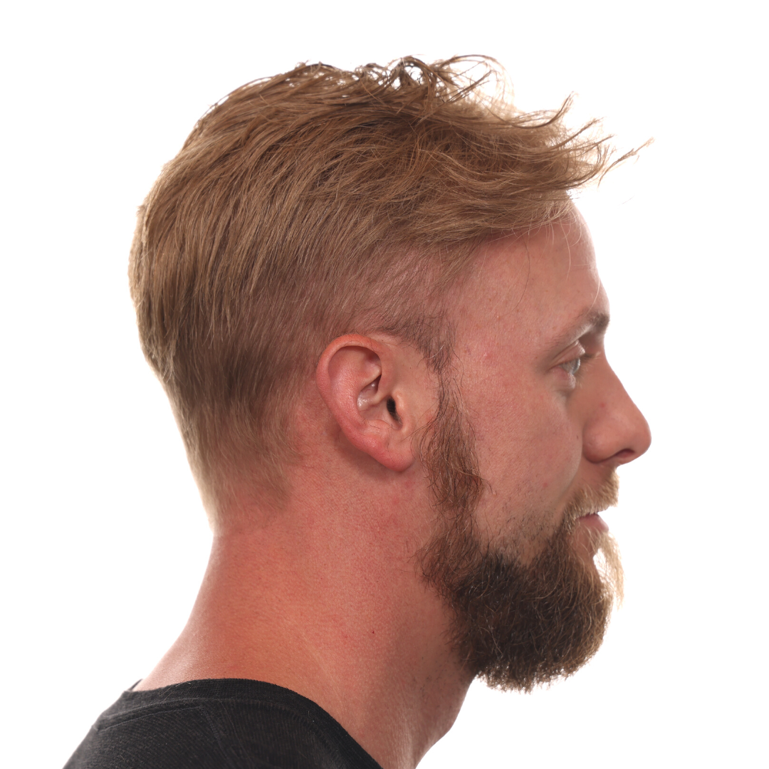 Nick-Jackson-Right-After