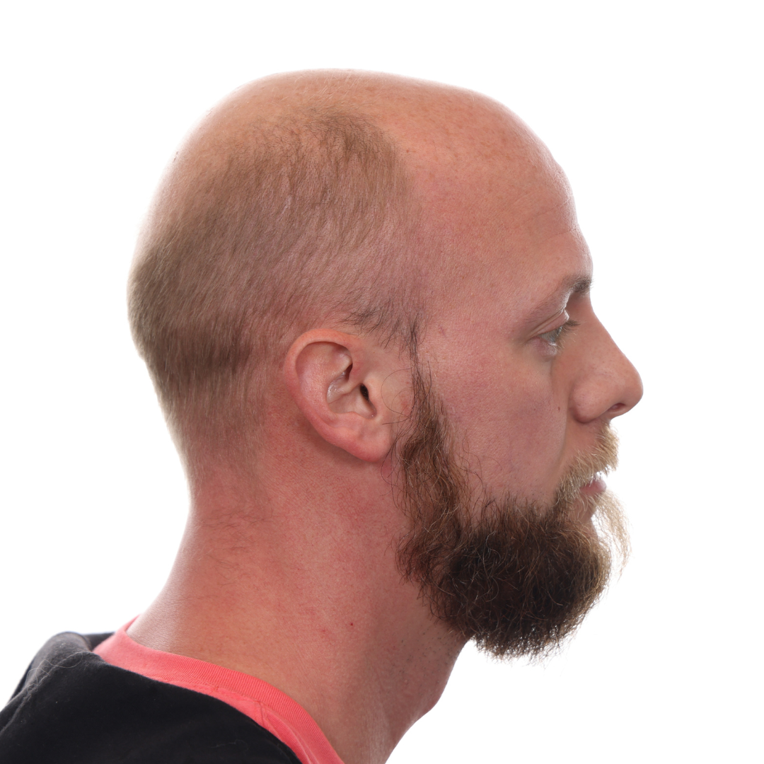 Nick-Jackson-Right-Before