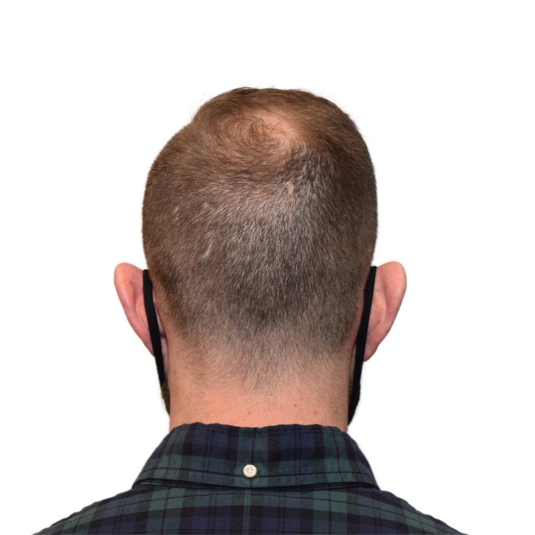 Mark-Clarke-Back-Before