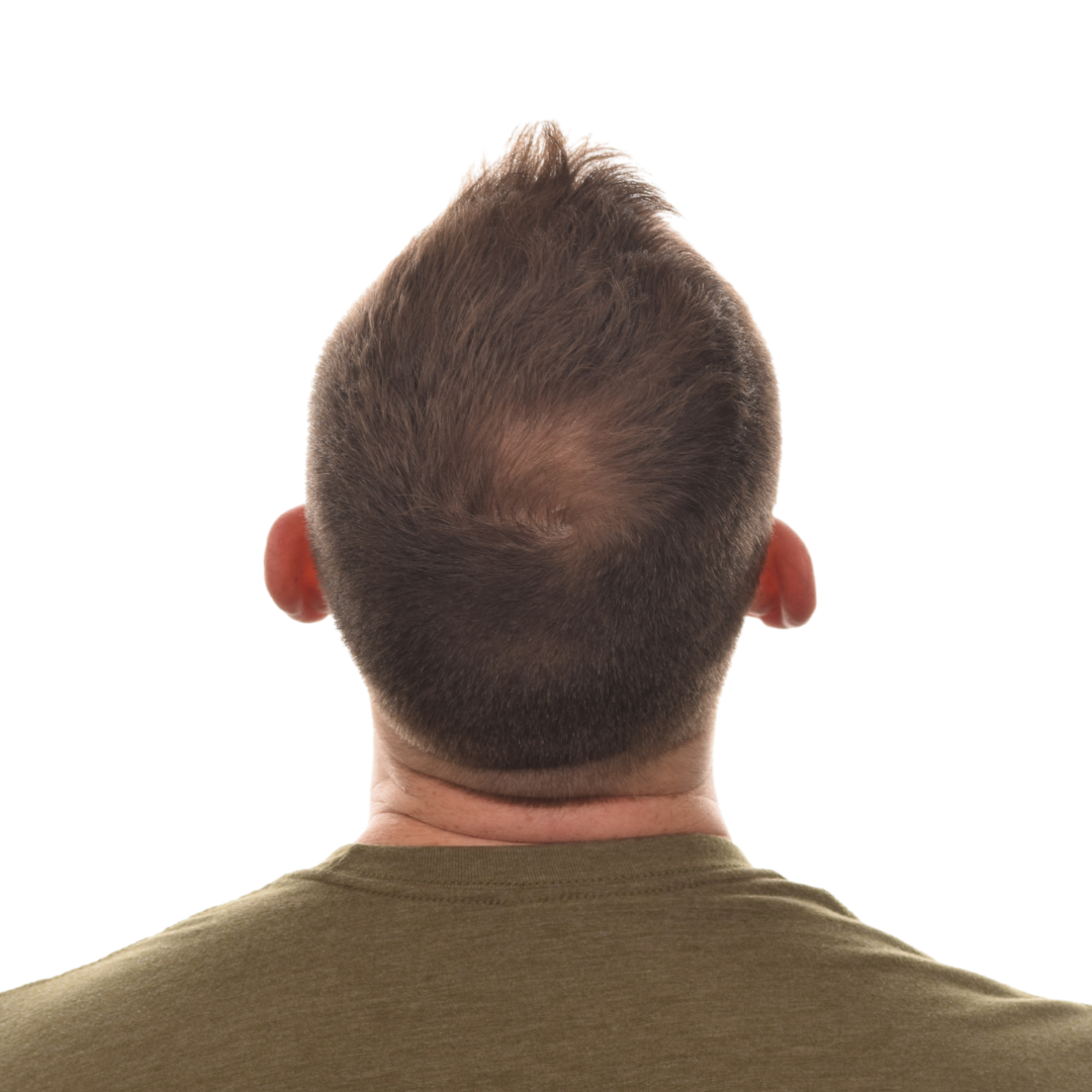 Mark-Clarke-Back-Tilt-After