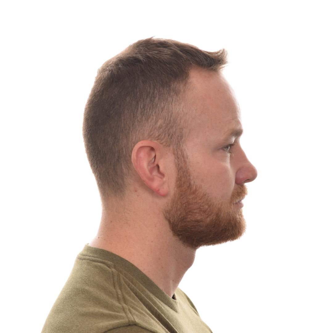 Mark-Clarke-Left-Side-After