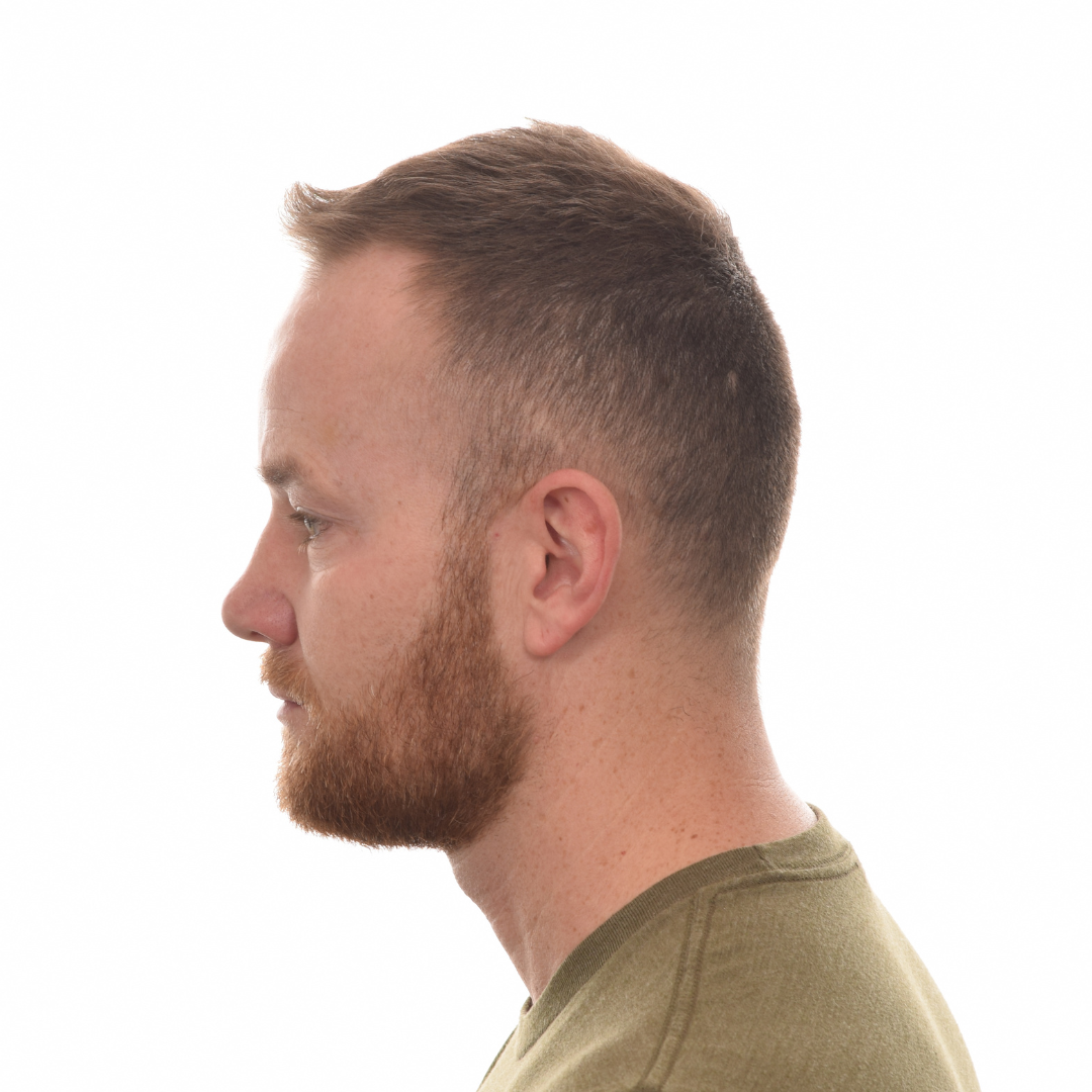 Mark-Clarke-Right-side-After