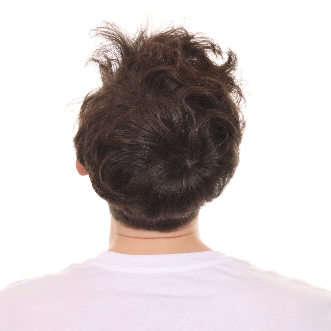 Stuart-Rhonemus-Back-After