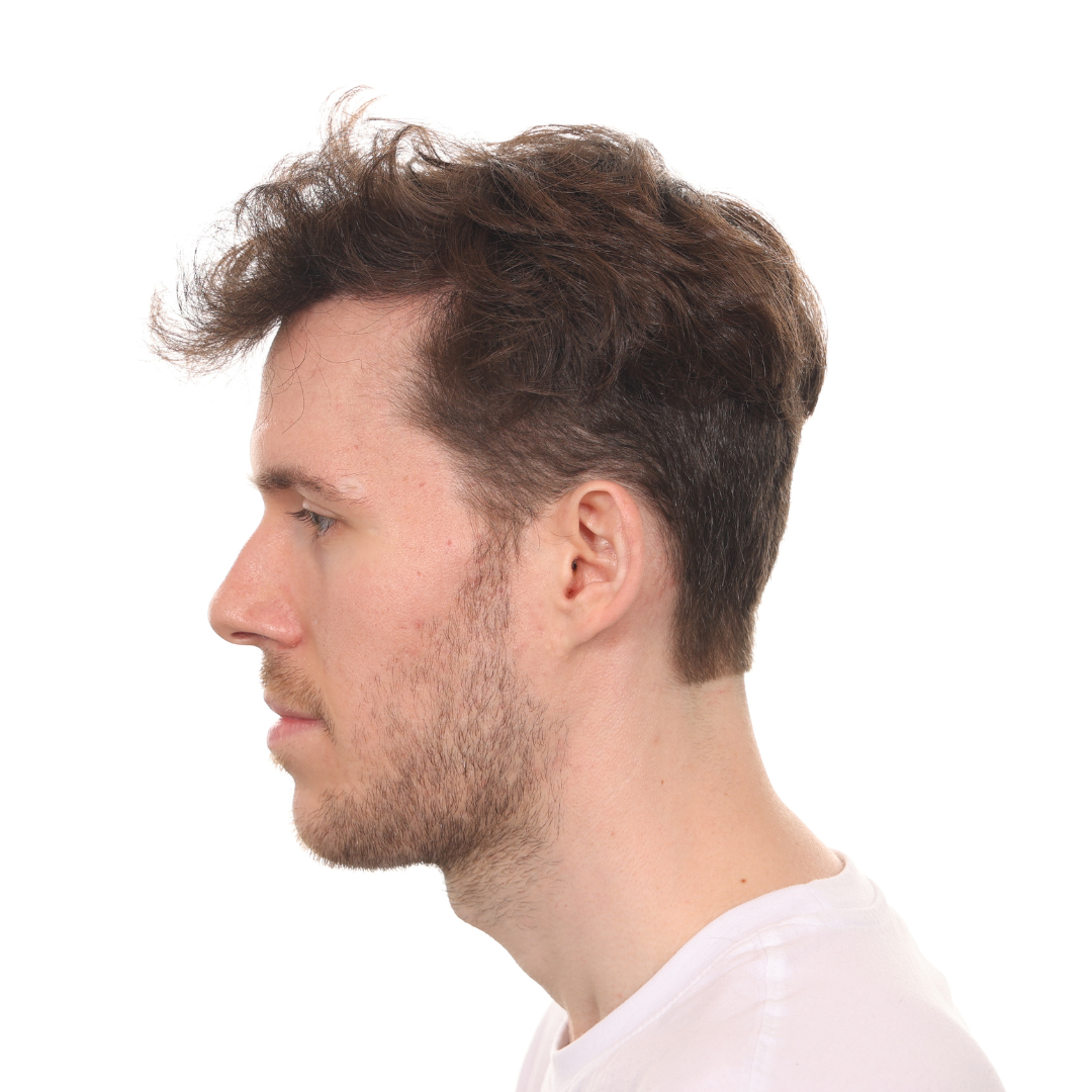 Stuart-Rhonemus-Left-After