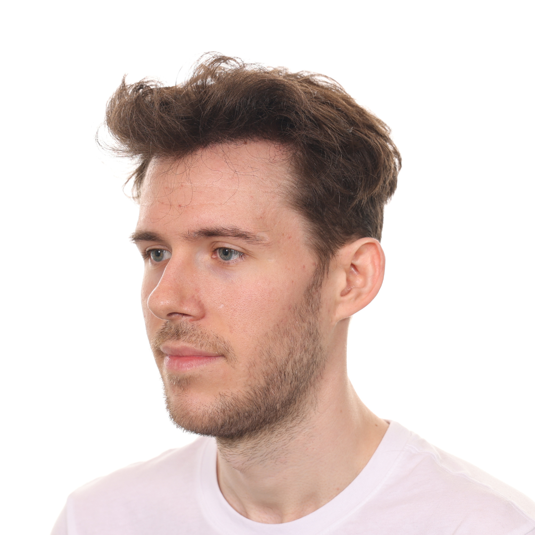 Stuart-Rhonemus-Left-Angle-After