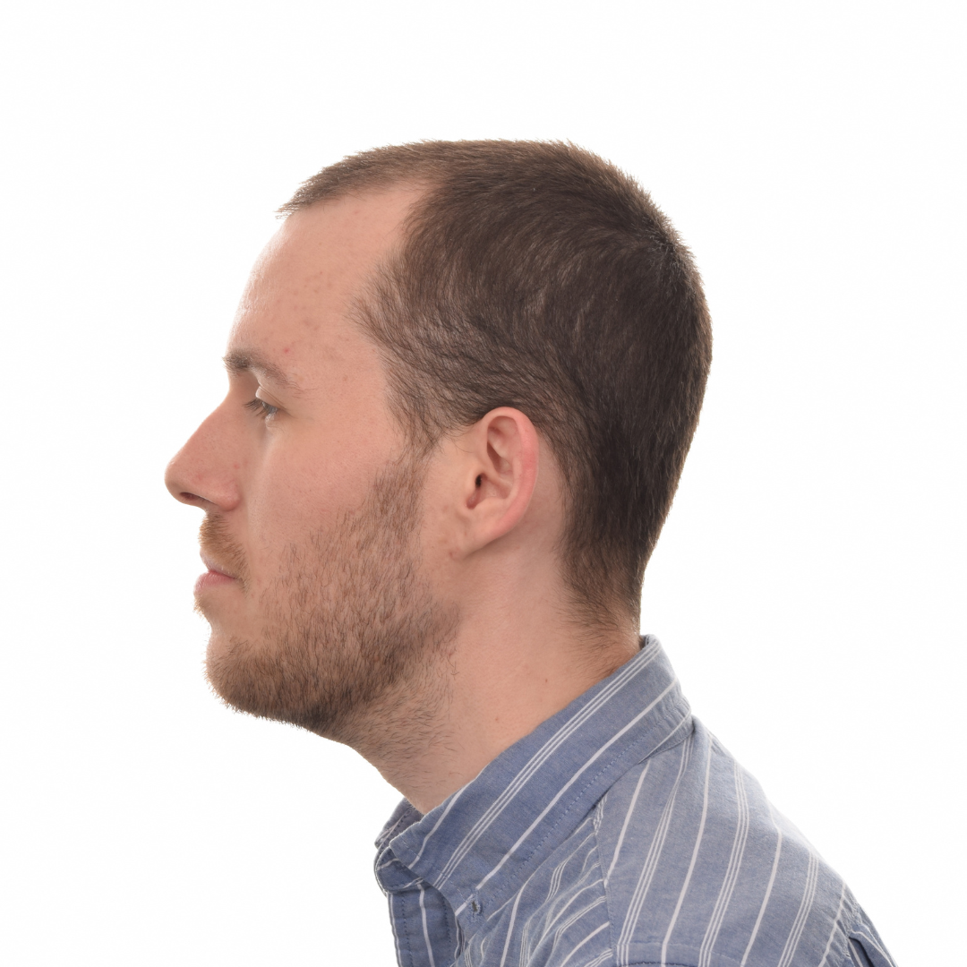 Stuart-Rhonemus-Left-Before