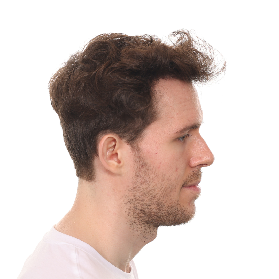 Stuart-Rhonemus-Right-After