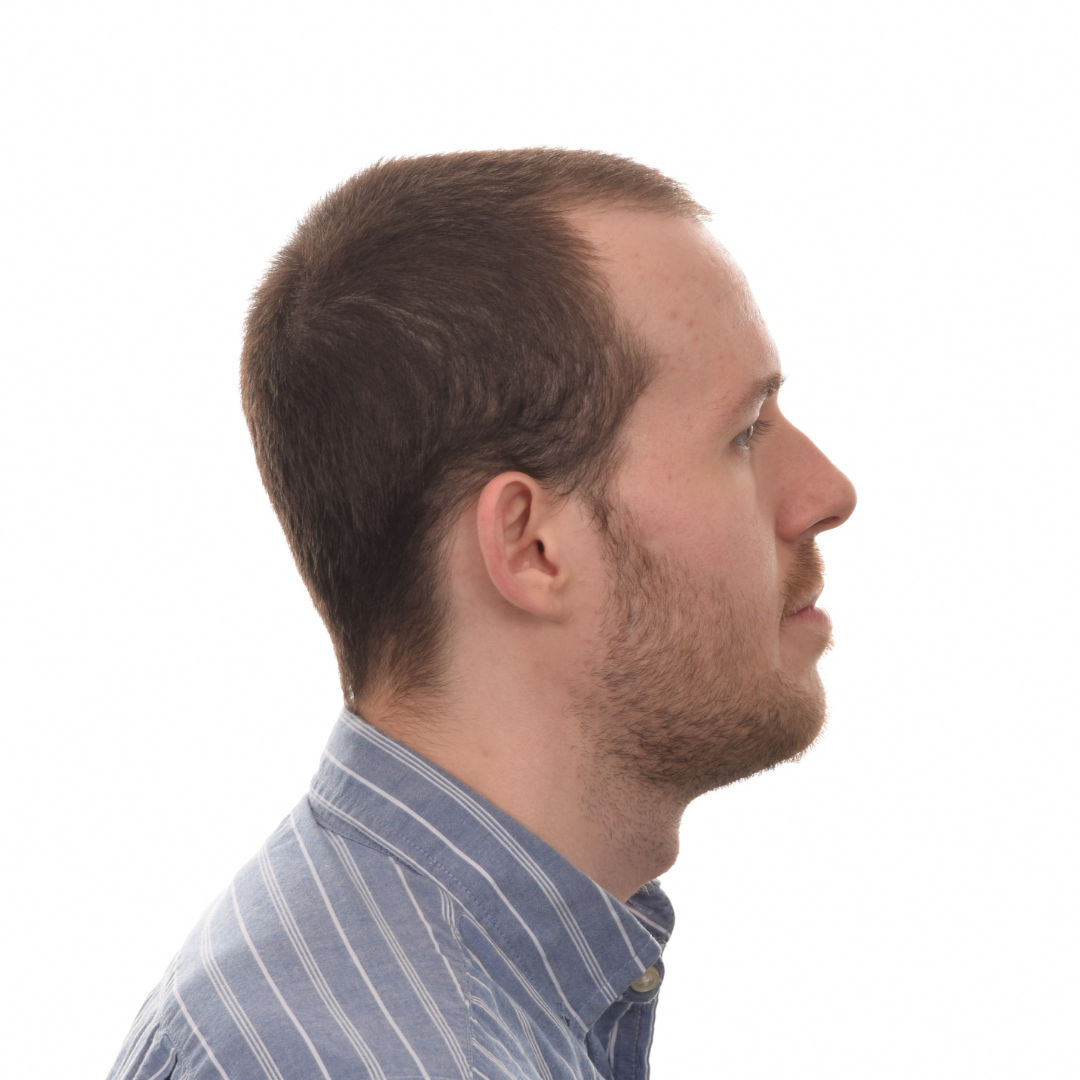 Stuart-Rhonemus-Right-Before