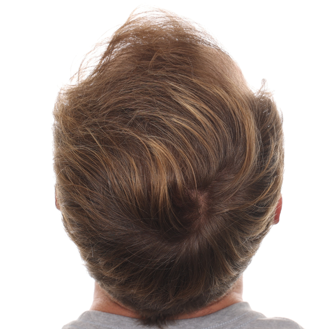 Andrew-Popielski-back-tilt-after