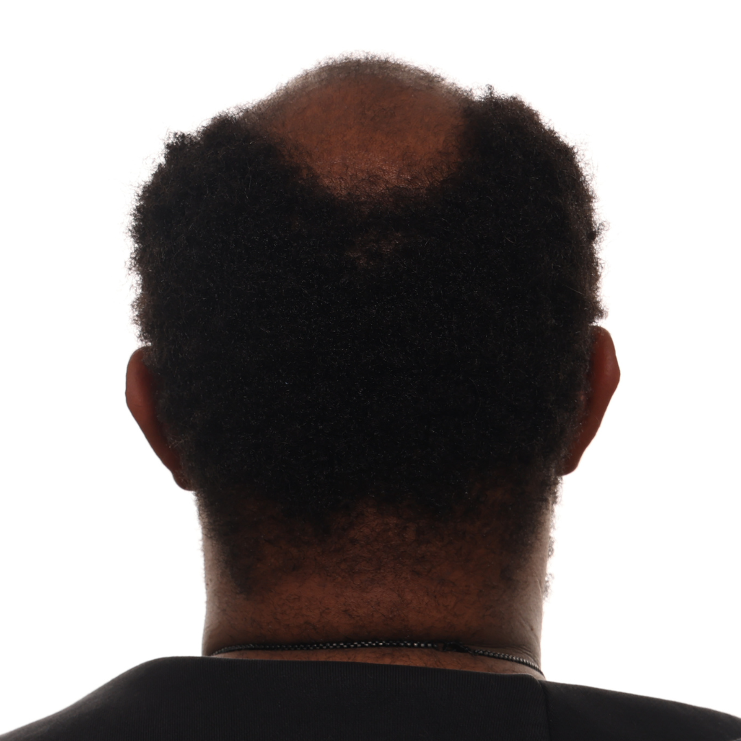 Daniel-Cole-back-before