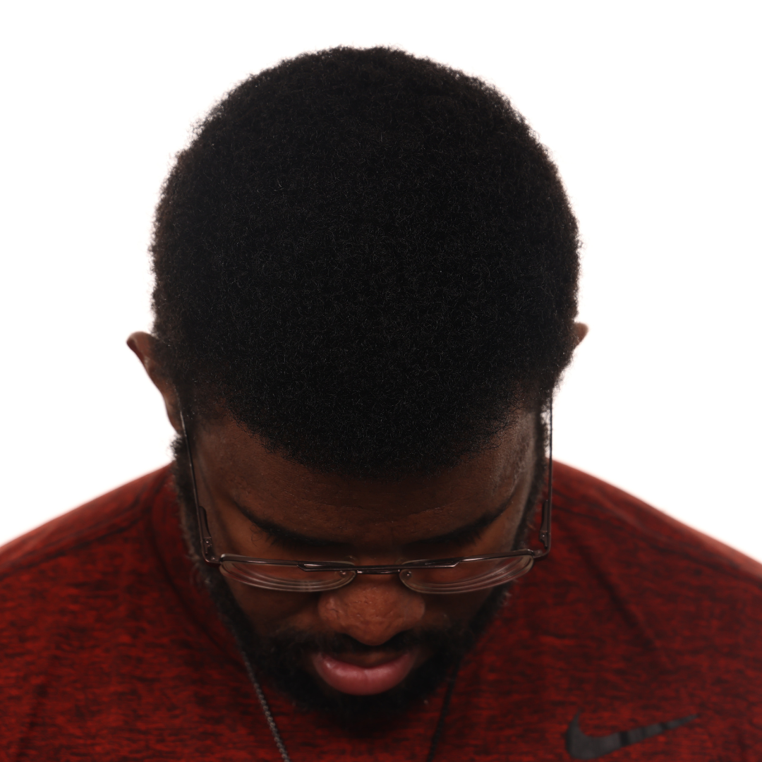 Daniel-Cole-front-tilt-after